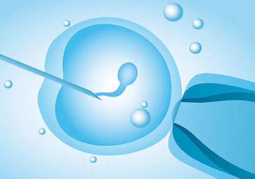 試管嬰兒的費用是多少