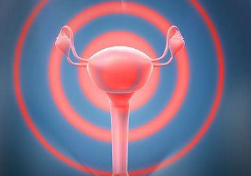 ?泰國(guó)試管嬰兒費(fèi)用是多少?