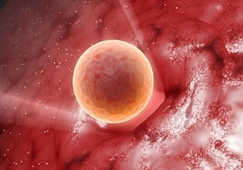 俄羅斯試管嬰兒做一次多少錢？?