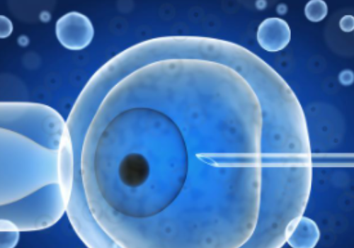 俄羅斯做試管一次多少錢？